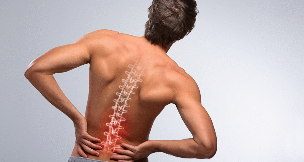 Artrodese Lombar: Quando é Necessária e Como é a Recuperação